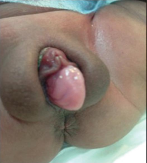 I open my anus Free online fuck buddies